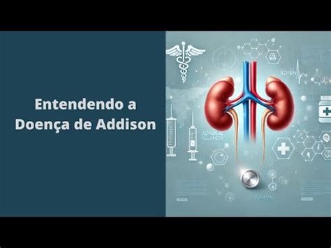 addidon|Doença de Addison: o que é, causas, sintomas e tratamento